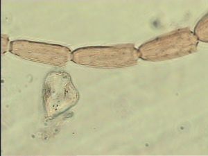 exiguosimilis Htype 8.jpg