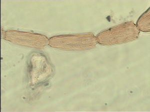 exiguosimilis Htype 9.jpg