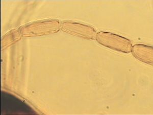 flavicornis Htype 6.jpg