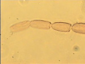 flavicornis Htype 9.jpg