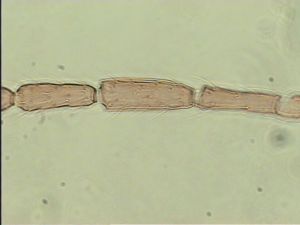 neobrevior Htype 6.jpg