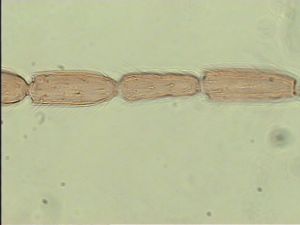 neobrevior Htype 7.jpg