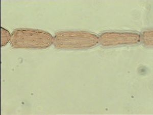 neobrevior Htype 8.jpg