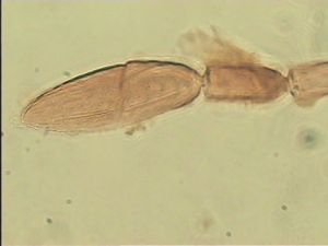 obsoleta Htype 11.jpg