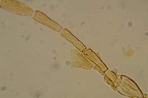 obsoleta Htype 16.jpg