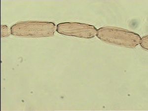 silesica Htype 13.jpg