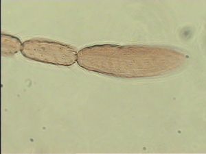 silesica Htype 14.jpg