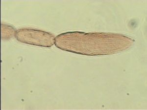 silesica Htype 15.jpg