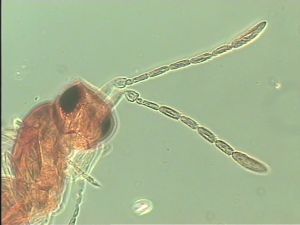 silesica Htype 8.jpg