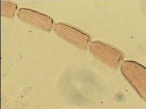 similis Htype 10.jpg