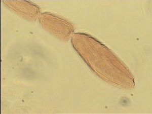 similis Htype 11.jpg