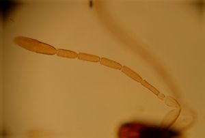 vulgaris Htype 2.jpg