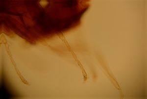 vulgaris Htype 4.jpg