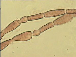 angustipennis Soyka Htype 6.jpg