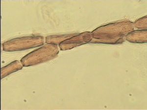 angustipennis Soyka Htype 7.jpg