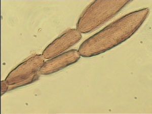 angustipennis Soyka Htype 8.jpg