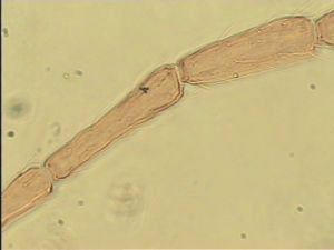 wolfsthali Htype 10.jpg