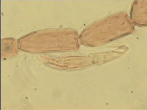 wolfsthali Htype 11.jpg