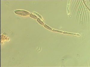 wolfsthali Htype 7.jpg