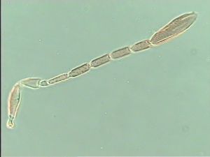 Th187-1 crassipennis.jpg