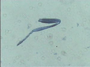 Anaphes bruxellensis 7.jpg